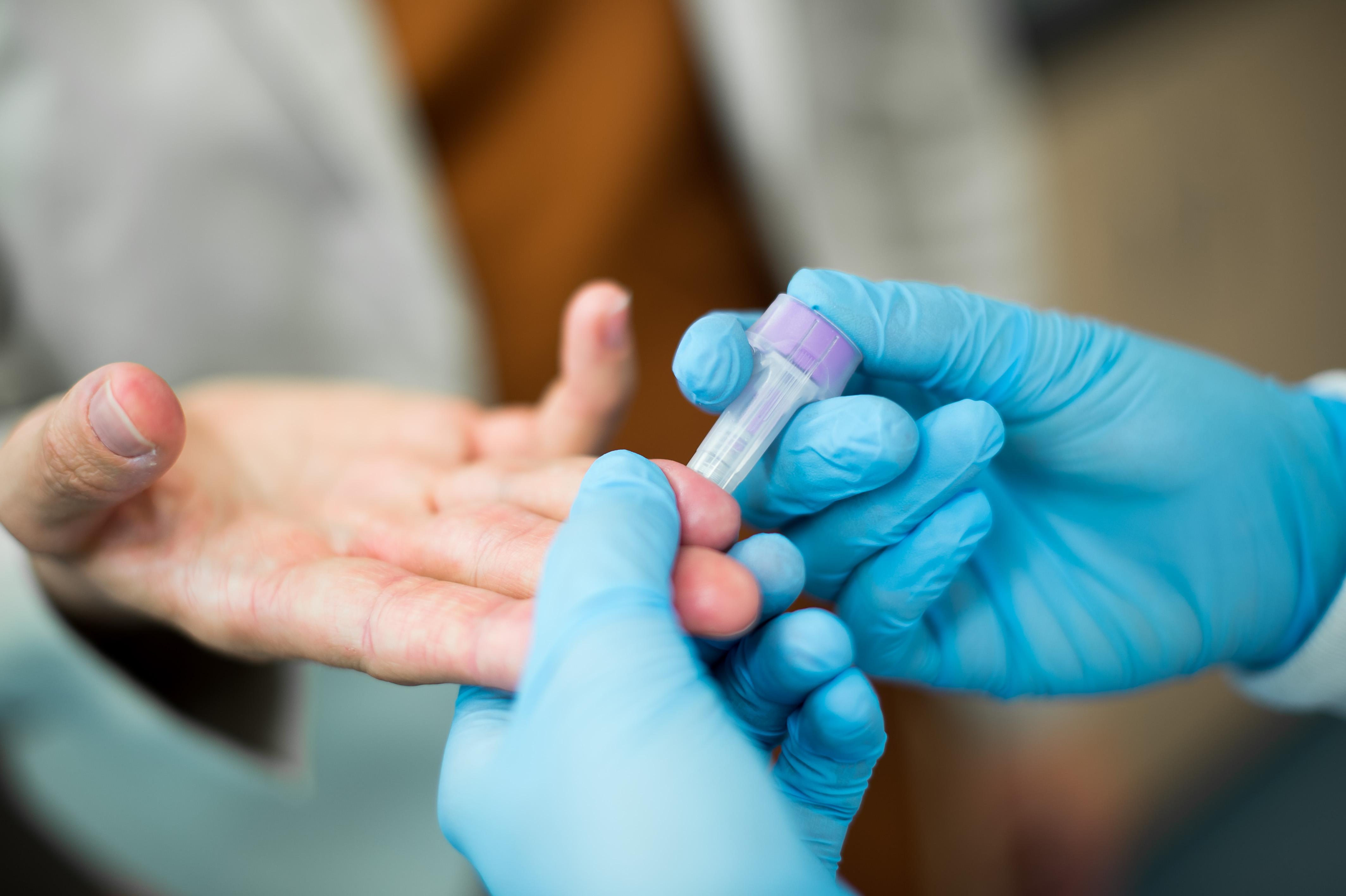 Identifying Signs of B12 Deficiency: When to ​Consider ⁤Supplements