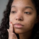 Acne Program– Action 11 Herbal Mixtures To Consume Alcohol