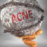 Acne Program – Action 8 Veggies to Consume Alcohol along with eat