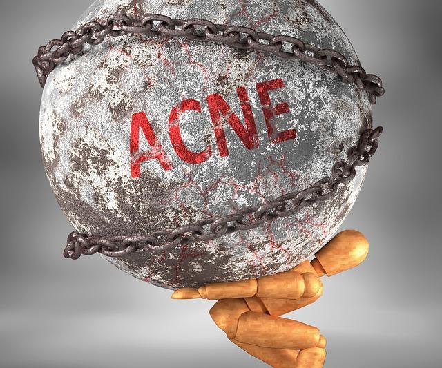 Acne Program – Action 8 Veggies to Consume Alcohol along with eat